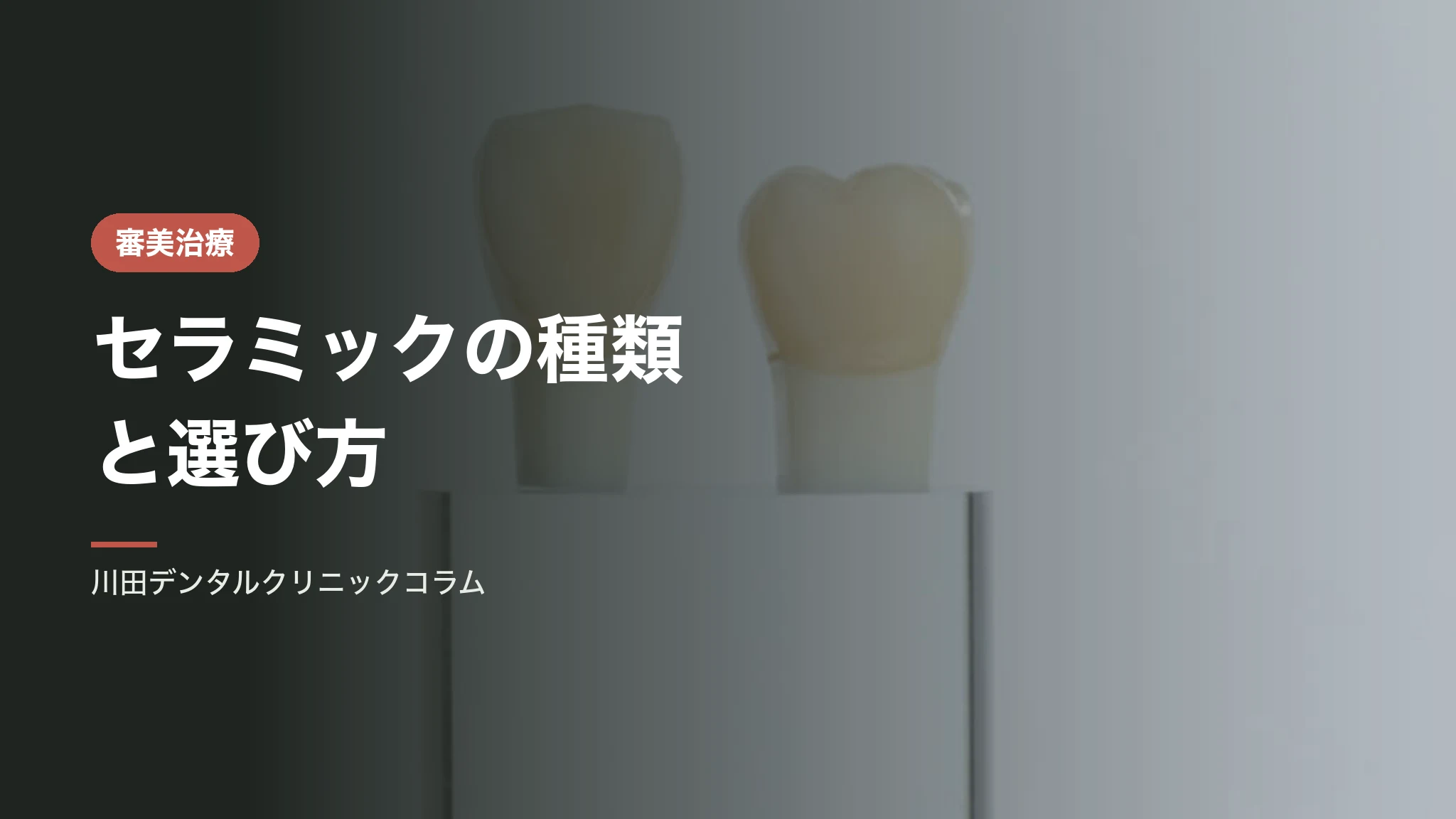 セラミックの種類と選び方｜素材ごとの違いと向き・不向き