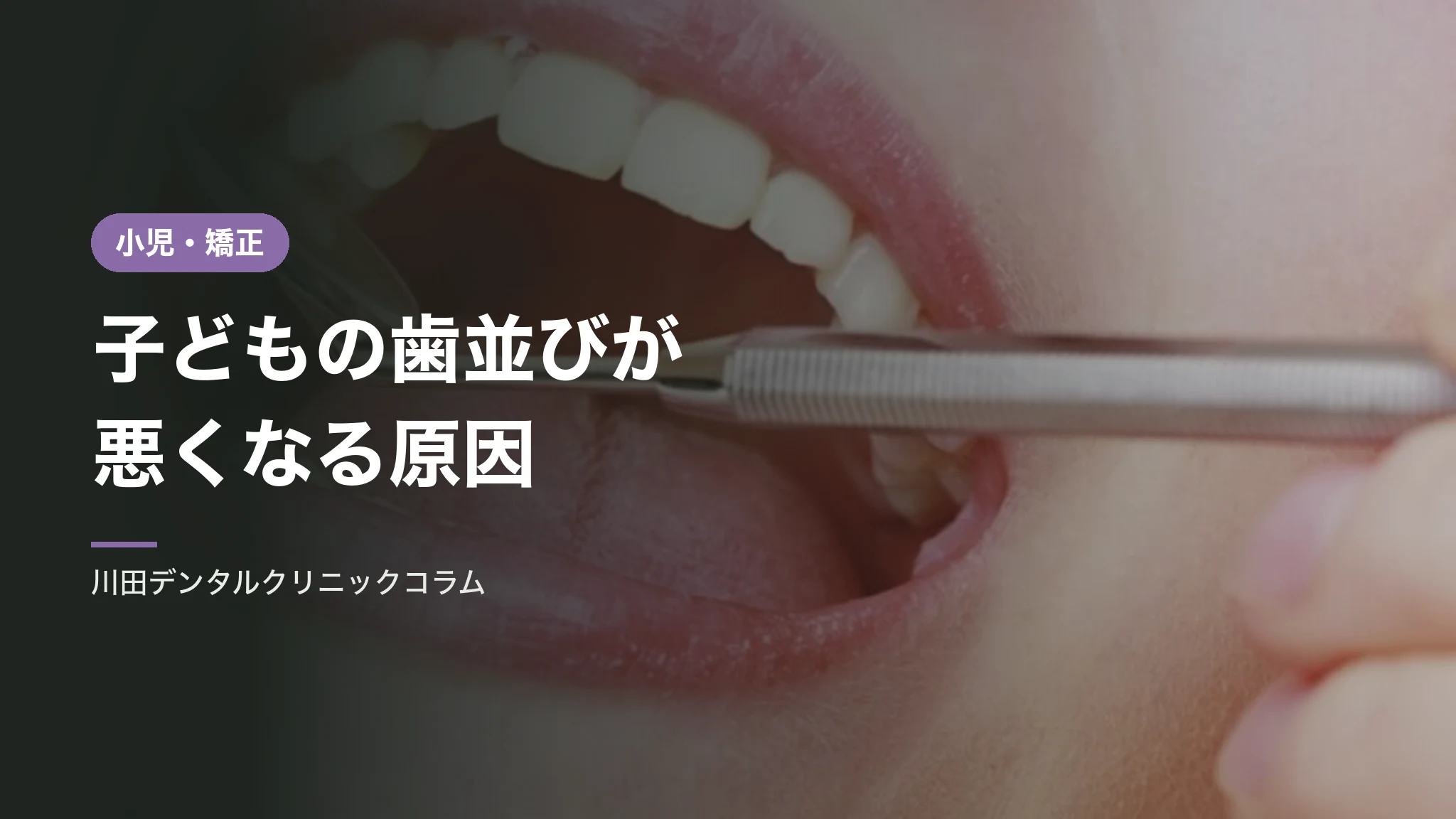 子どもの歯並びが悪くなる原因｜癖と口腔機能