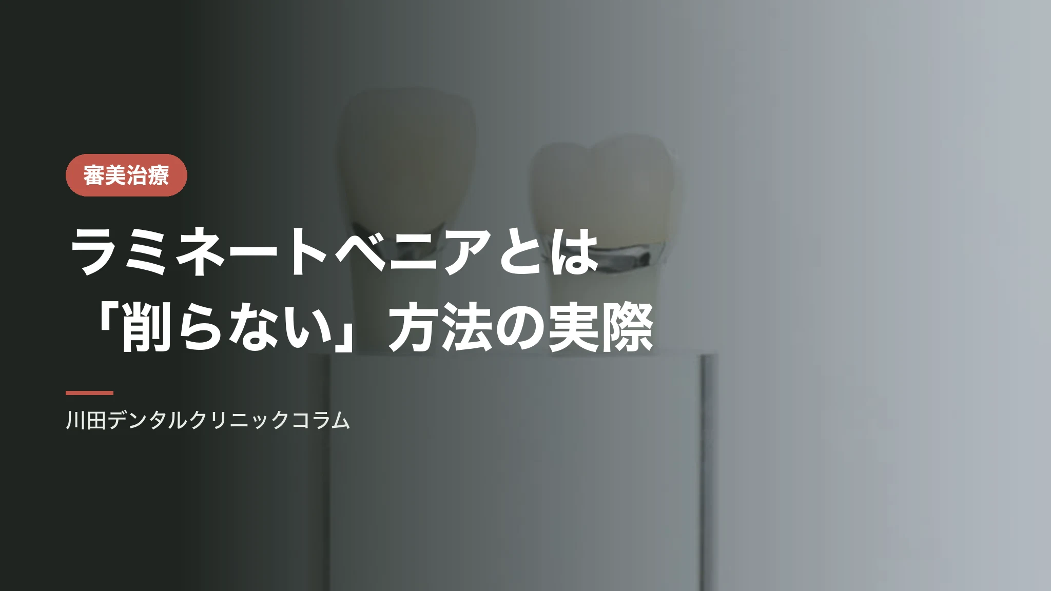 ラミネートベニアとは|「削らない」と言われる方法の実際