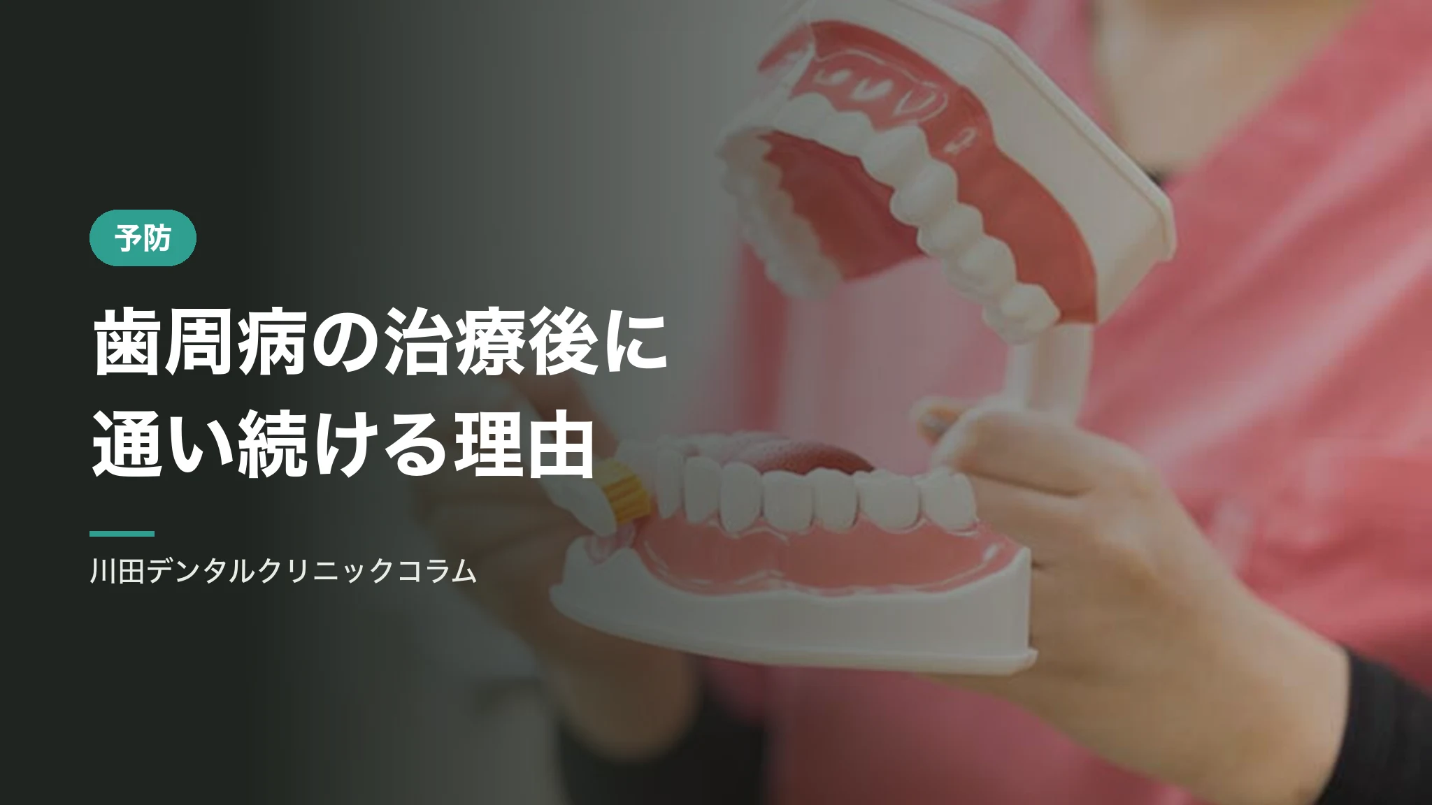 歯周病の治療が終わったあとに通い続ける理由｜メインテナンスの間隔
