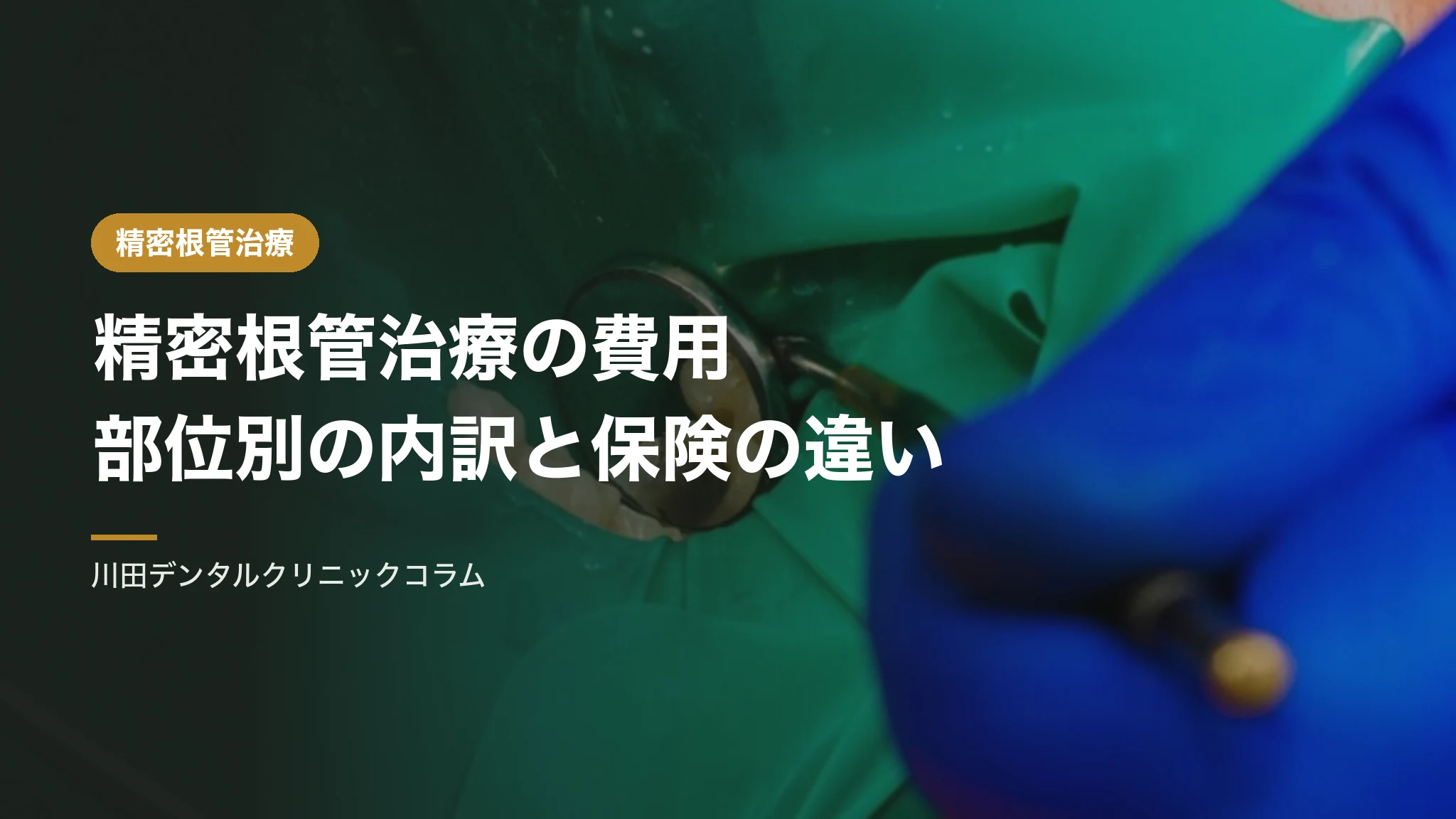 精密根管治療の費用｜部位別の内訳と保険診療との違い