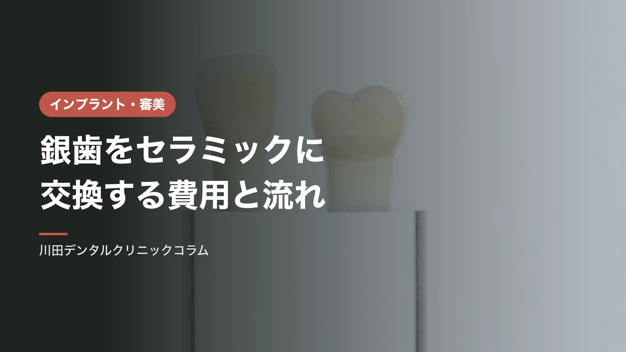銀歯をセラミックに交換する費用と流れ